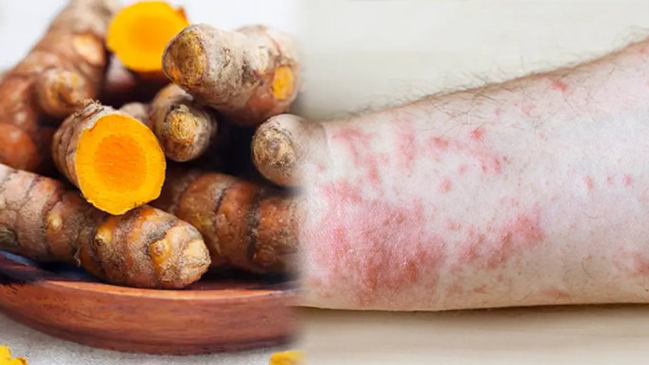 कच्ची हल्दी खाने के है ये गंभीर नुकसान । Kachi Haldi Khane Ke Nuksan । Boldsky *Health