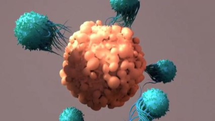 Nuova terapia per malattia di Waldenstrom, rara forma linfoma