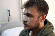 İzmir'de darp edilen asistan doktorun burnu kırıldı