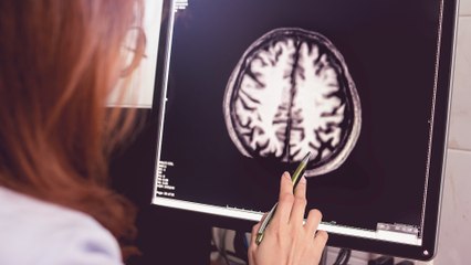 ابتكار عقار تجريبي لمرض ألزهايمر يبطئ تطور المرض