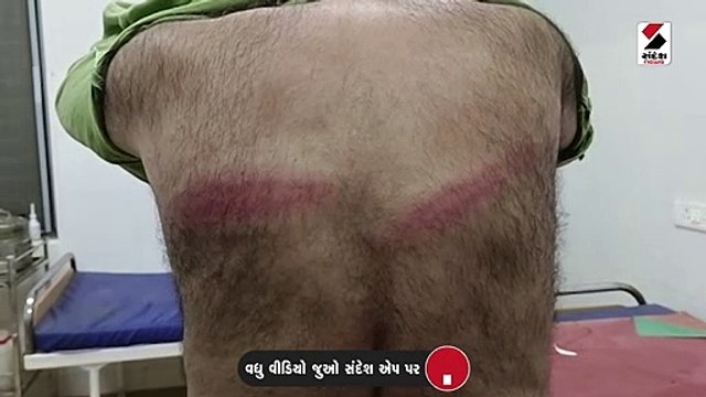 નવસારી બેઠક: વાંસદાના ભાજપ ઉમેદવાર પિયુષ પટેલ પર અજાણ્યા લોકોએ કર્યો હુમલો