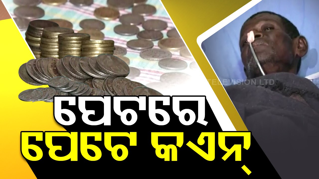 Coins recovered from man’s stomach after surger...