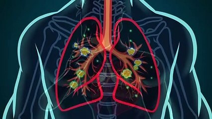 Video Animasi Rokok dan Covid-19 - Bahaya Merokok