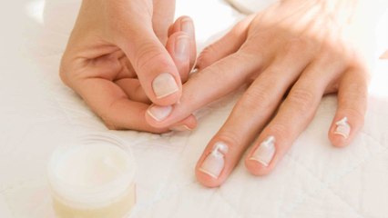 Risse an der Nagelhaut: Mit diesen Blitz-Tipps könnt ihr ihnen vorbeugen