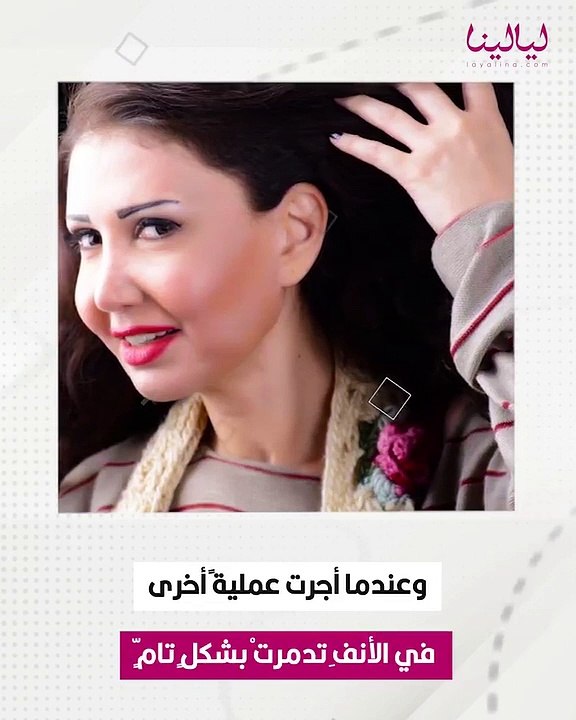 نجمات تغيرت ملامحهم تماما بسبب عمليات التجميل الفاشلة