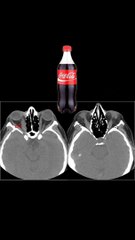 Signo de la botella de Coca-cola