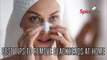 Best Tips to remove blackheads at home