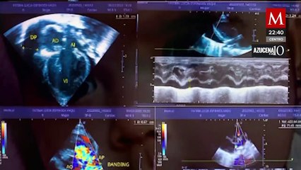 Hace seis meses Fátima nació con medio corazón, sus padres piden apoyo