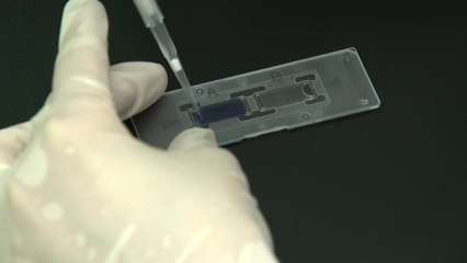 난치성 백혈병 치료하는 체내 NK세포 10배 배양 기술 확보 / YTN