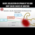 Injury, dislocation or sprain of the arm joint can be causes of arm pain
