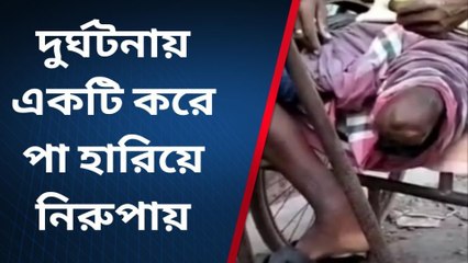 জলপাইগুড়ি:ভয়াবহ দুর্ঘটনা !কাটা গেল দুটো পা !শেষ পরিণতি ভয়াবহ