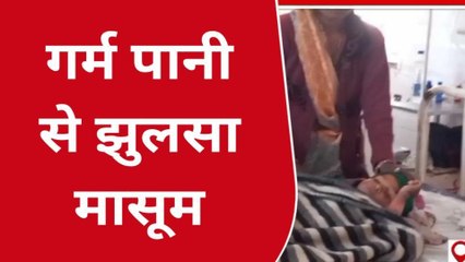 बांसवाड़ा: चूल्हे पर रखे हुए पानी के तपेले से मासूम झुलसा जिला अस्पताल में भर्ती ,देखिए ख़बर