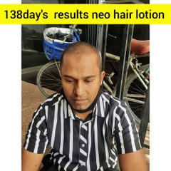 Neo hair lotion it’s best results for scalp