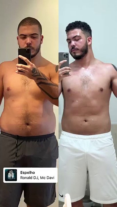 Antes e depois de Ronald, filho de Ronaldo Fenô...