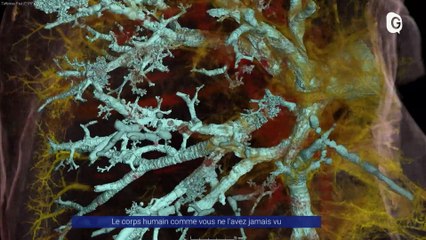 Reportage - Le corps humain comme vous ne l'avez jamais vu - Reportages - TéléGrenoble