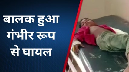 कौशाम्बी: दो मंजिला मकान से गिरा बालक, टूटा शरीर का यह अंग, हालत गंभीर