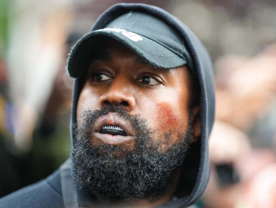 Londoner Studio entfernt kostenlos Kanye-West-Tattoos