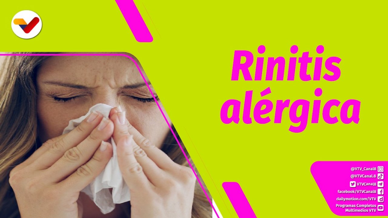 Buena Vibra | ¿Cómo evitar la rinitis alérgica en Navidad?