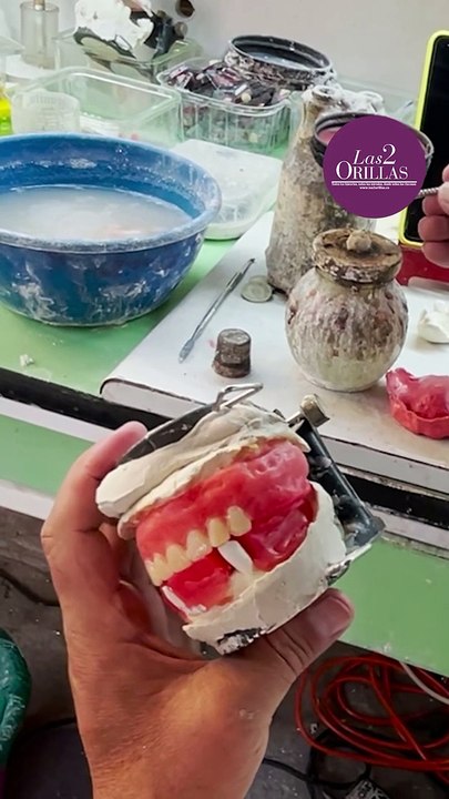 Dientes
