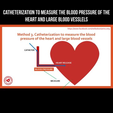 Catheterization to measure the blood pressure of heart and large blood vessels