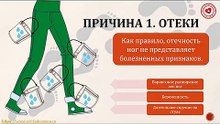 Что можно сделать при отеках?