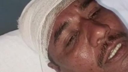 मथुरा: शराब पीने की मना पड़ा भारी, दबंगों ने मारपीट कर किया ये हाल