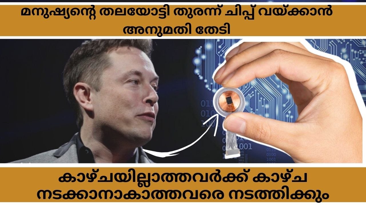 Elon Musk | Brain Chip Implant | തലച്ചോറ് കമ്പ്യൂട്ടറാക്കാൻ ഇലോൺ മസ്ക് | Neuralink |