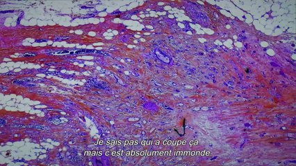 De Humani Corporis Fabrica Bande-annonce VF