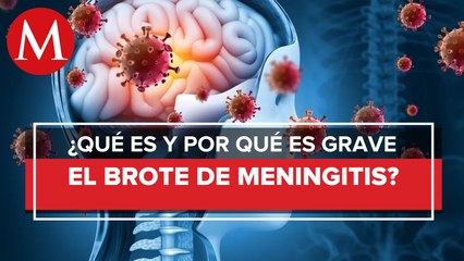 En Durango, meningitis aséptica registra más de 70 casos y 22 defunciones