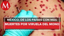 México tiene una de las tasas más altas de muertes por viruela del mono: experta