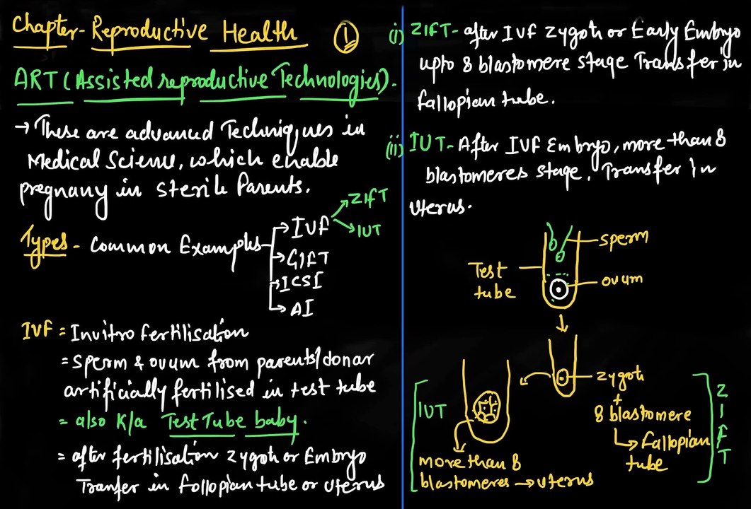 Reproductive health|Assisted reproductive technology