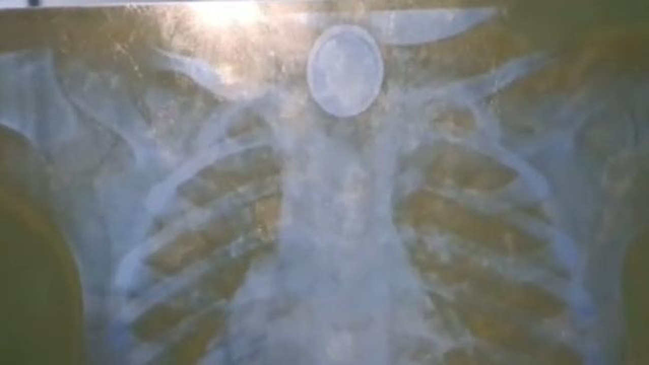 মর্মান্তিক!গলায় আটকে ব্যাটারি,একরত্তিকে নিয়ে কী করলো বাবা-মা?