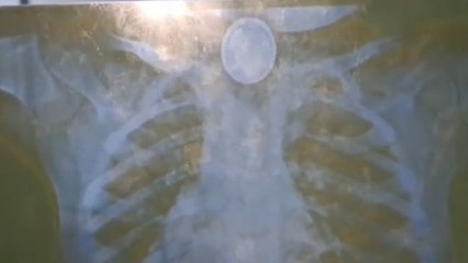 মর্মান্তিক!গলায় আটকে ব্যাটারি,একরত্তিকে নিয়ে কী করলো বাবা-মা?