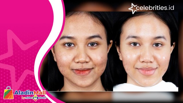 Mayang Operasi Hidung, Begini Reaksi Dody Sudrajat saat sang Anak Diserang Netizen