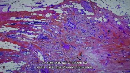 De Humani Corporis Fabrica Bande-annonce VF (2023) Verena Paravel, Lucien Castaing-Taylor