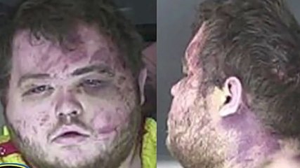 Colorado LGBT+ nightclub shooting suspect charged with 305 counts