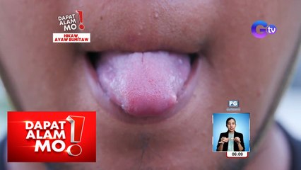 Piercing, bumaon sa dila ng isang lalaki! | Dapat Alam Mo!