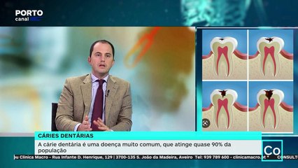Consultório - Cáries Dentárias - Clínica Macro - reabilitação oral