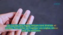 3 choses à savoir sur les ongles abîmés