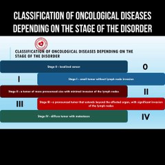 Classification of oncological diseases depending on the stage of the disorder