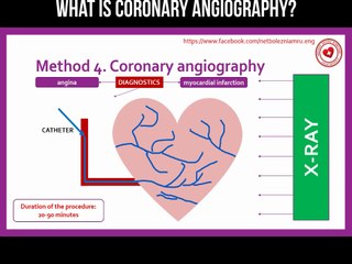 What is coronary angiography?