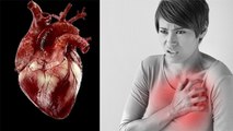 Silent Heart Attack का कारण और लक्षण क्या है | Symptoms Of Silent Heart Attack | Boldsky *Health
