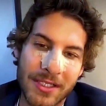 Bir Peri Masalı'nın Zafer'i estetik iddialarına yanıt verdi! 'Ben de geri zekalıyım'