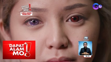 Mata ng isang babae, walang tigil sa pagluha at ‘di na maimulat dahil sa contact lens! | Dapat Alam Mo!