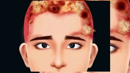 Asmr treatment for Nails,head, eyes Daily asmr videos for fungal infection treatment