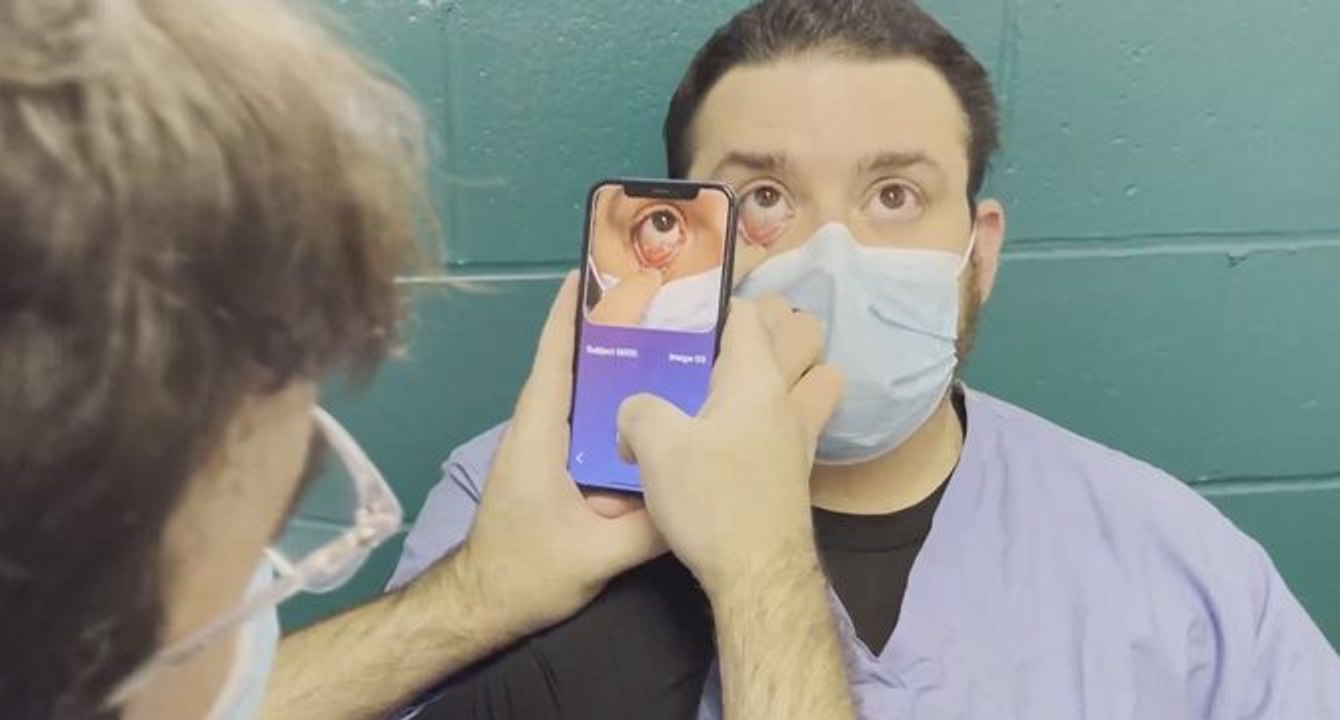 Türk hekimden çığır açacak buluş: Kansızlık hastanın gözünden anlaşılacak