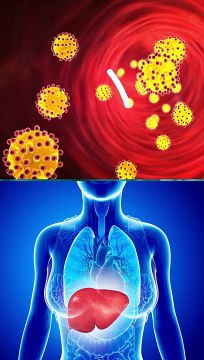 Raise Your HDL naturally (Improve Good Cholesterol) | DM HEART CARE CLINIC
