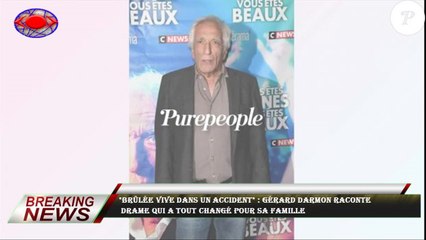 "Brûlée vive dans un accident" : Gérard Darmon raconte  drame qui a tout changé pour sa famille
