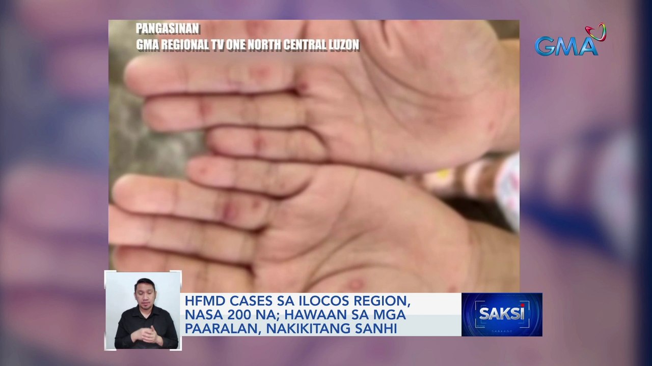 HFMD cases sa Ilocos Region, nasa 200 na; hawaan sa mga paaralan, nakikitang sanhi | Saksi