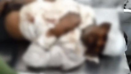 देवरिया: शराब के नशे में धुत गिरा एक व्यक्ति हुआ गंभीर रूप से घायल, देखें खबर